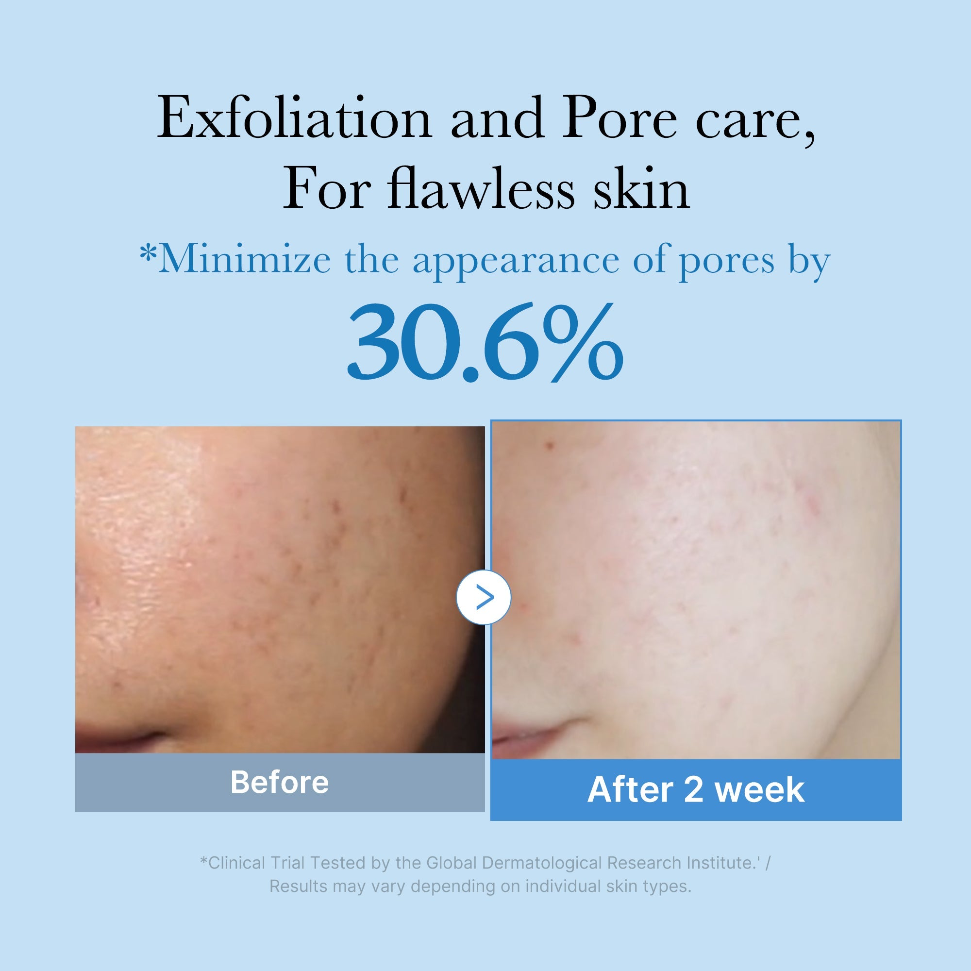 Zero Pore Toner - Meet the care behind beauty.