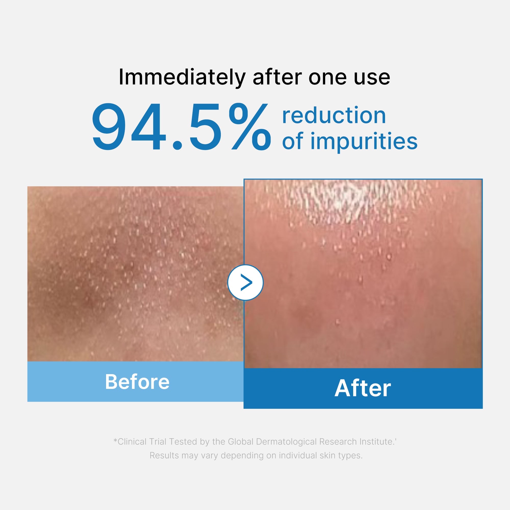 Zero Pore Blackhead Deep Cleansing Oil - Your routine has personality.