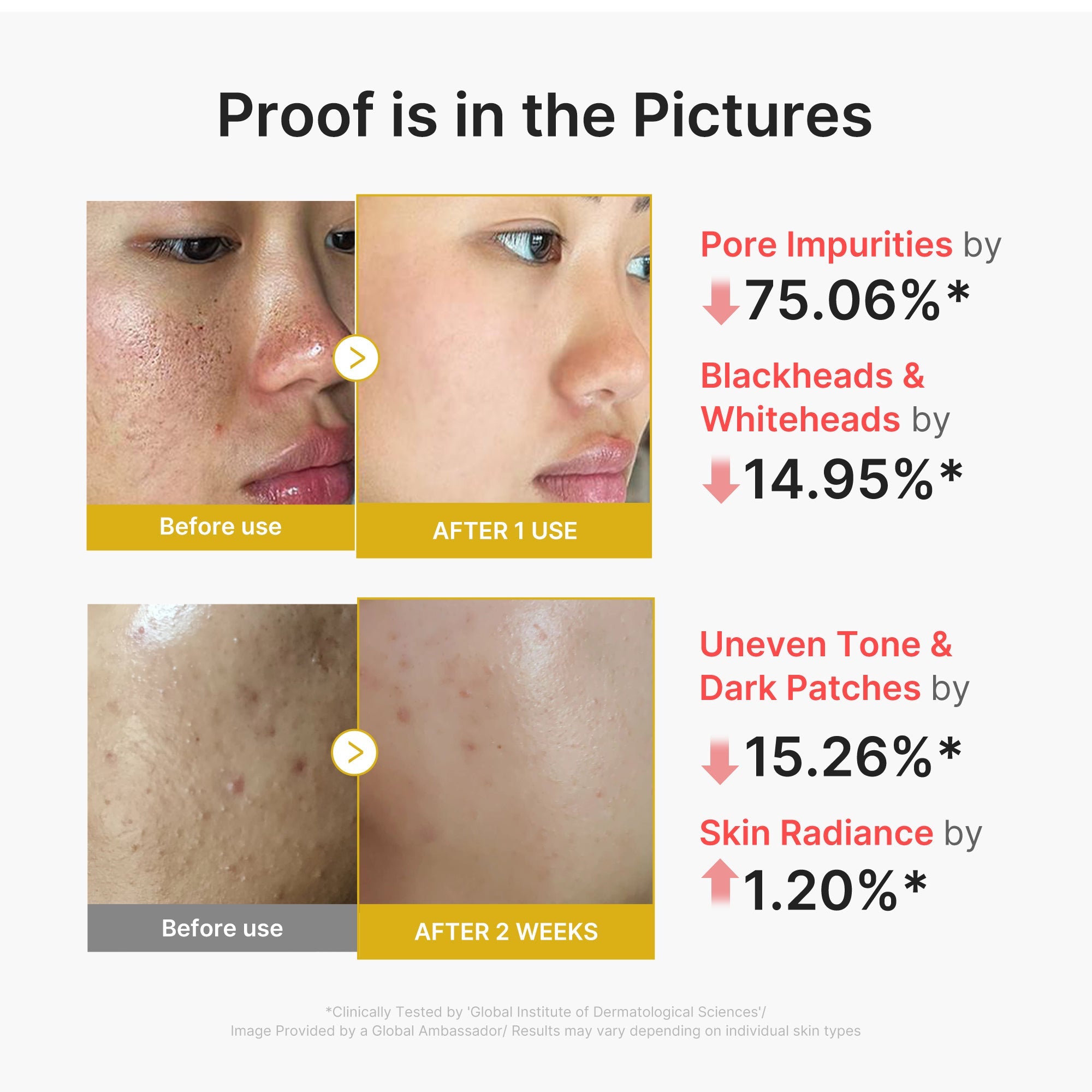 Kojic Acid Turmeric Peel Shot - Give yourself some margin.