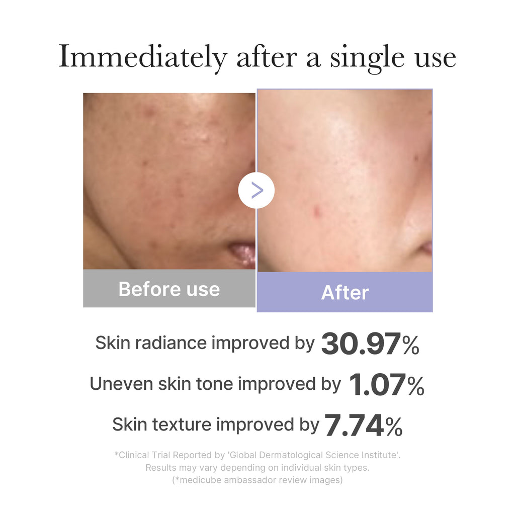 [CS] Mini Booster Pro - Care with a fresh perspective.