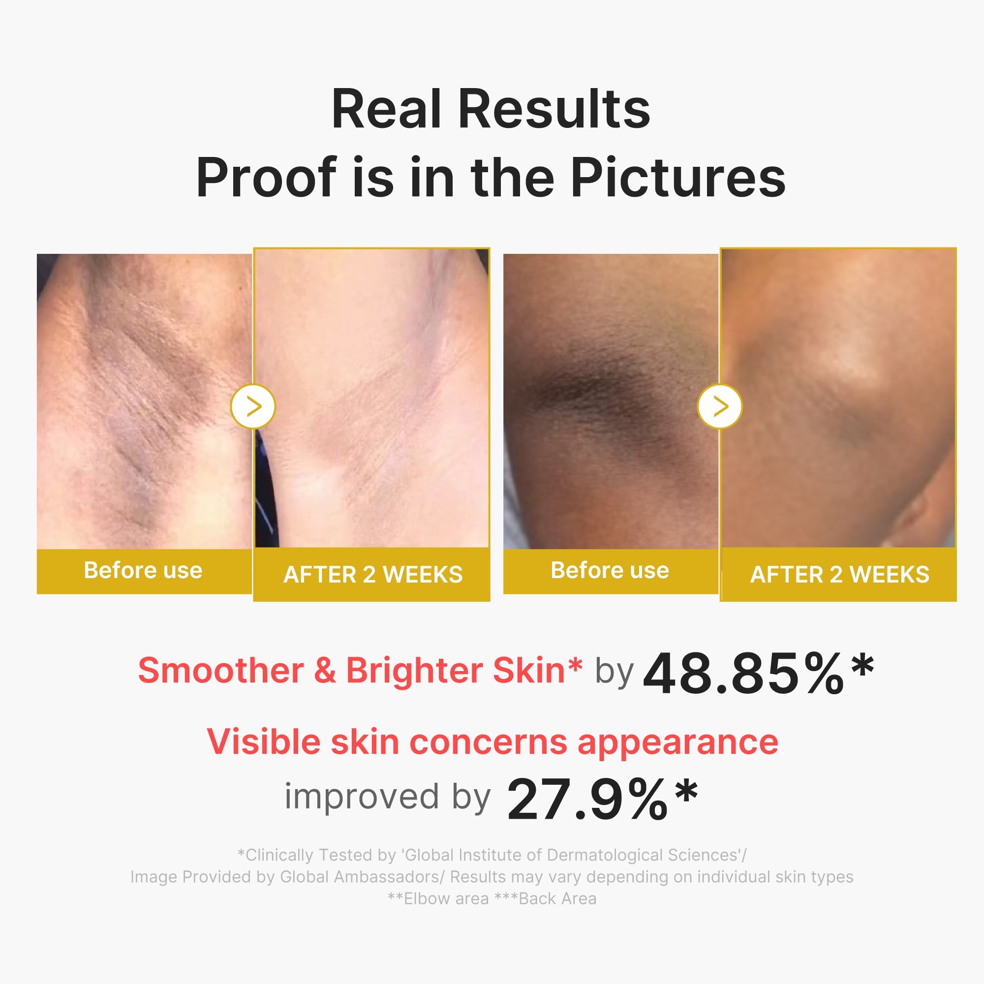 Kojic Acid Turmeric Body Peel Shot - A stylish little care ritual.