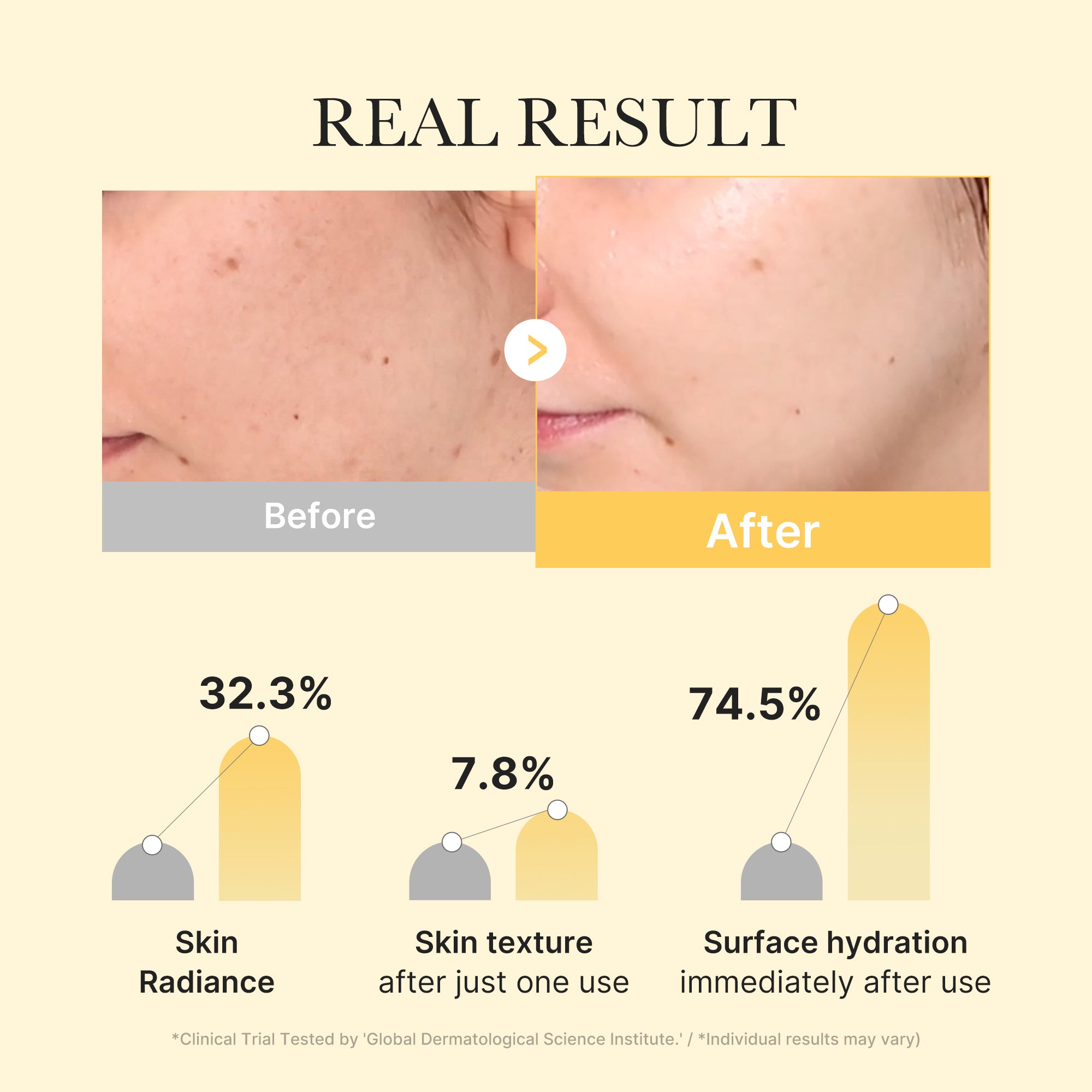 Kojic Acid Turmeric Gold Jelly Gel Mask - Leave room between your plans.