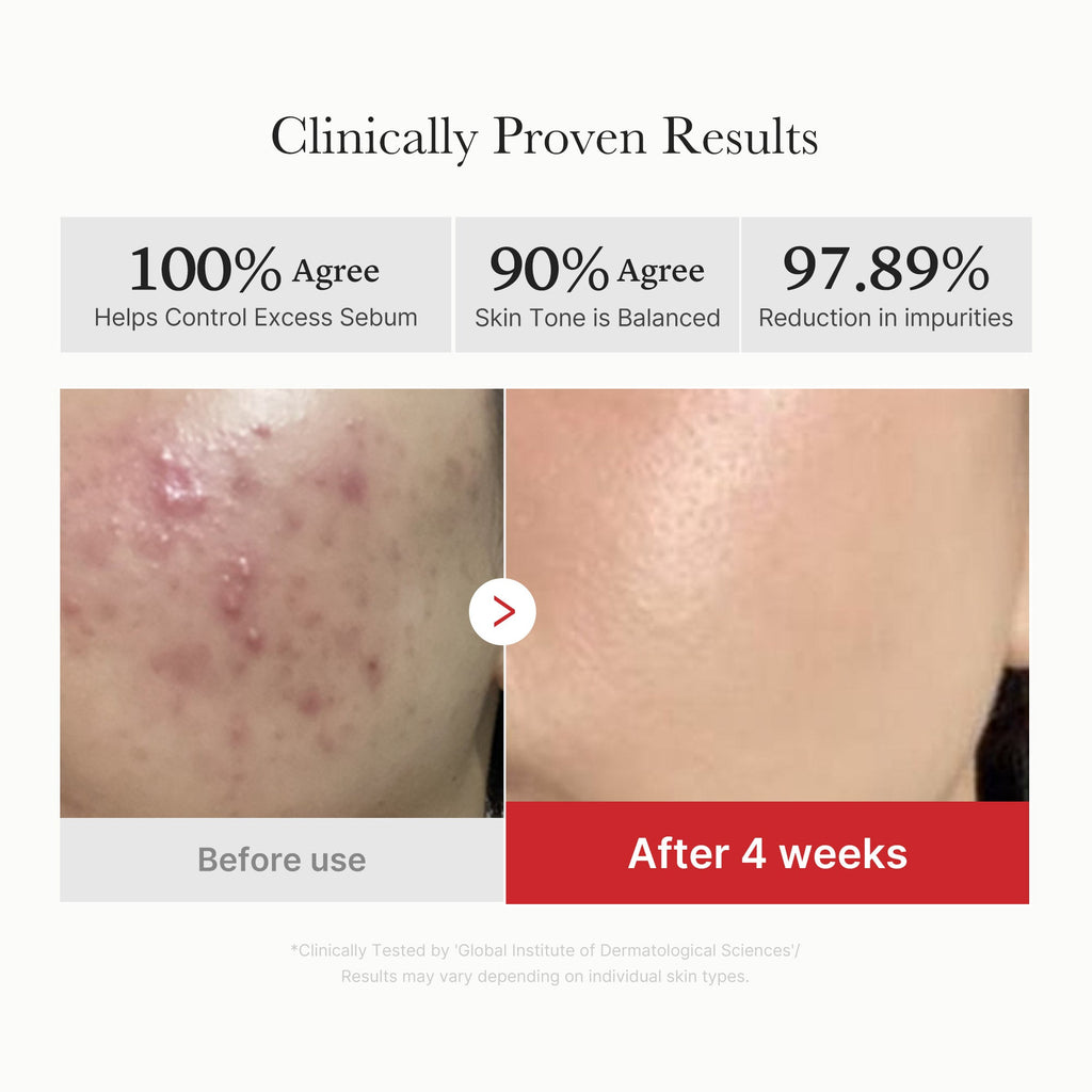 Red Succinic Acid Panthenol Pads - Let self-love take shape.