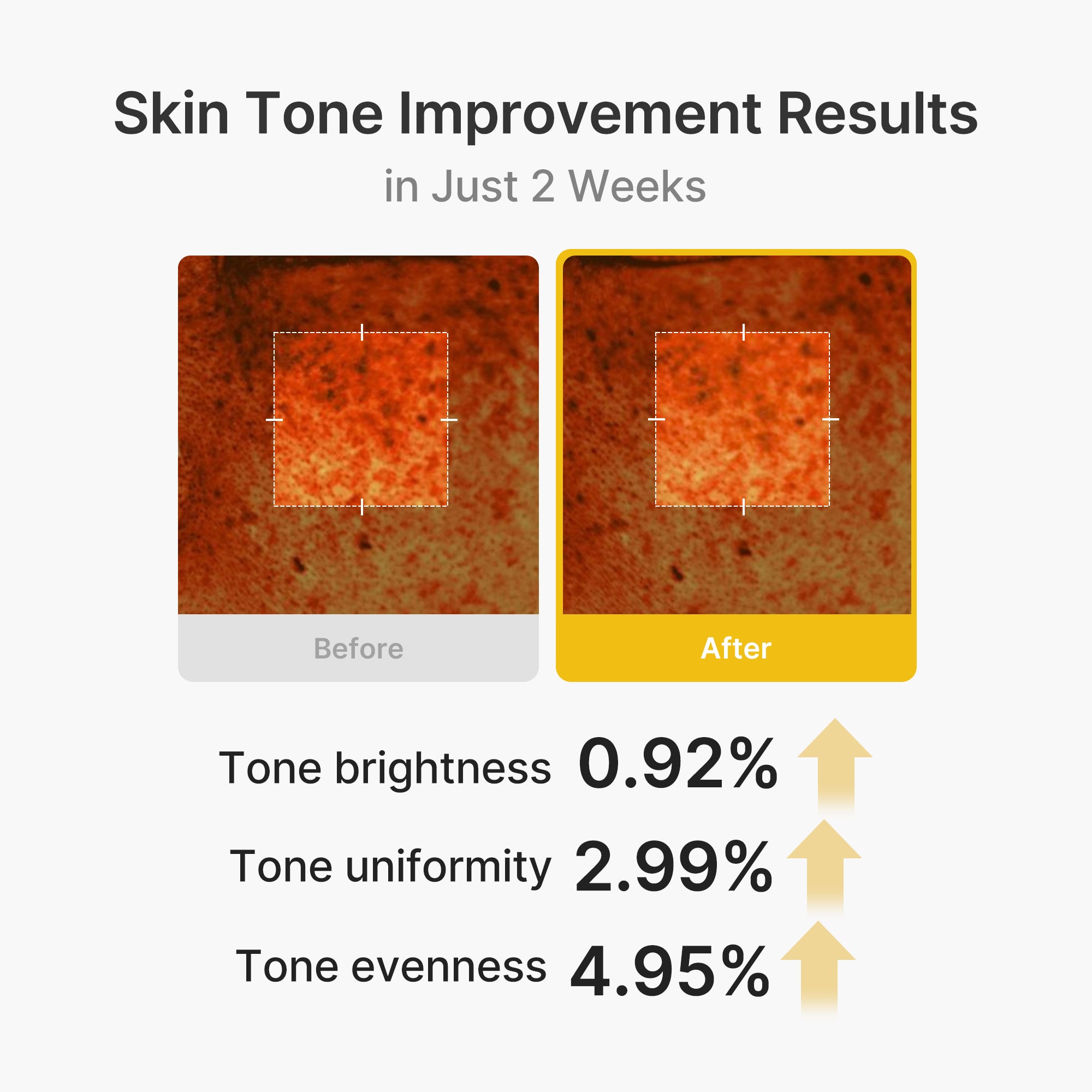 Kojic Acid Turmeric Vita Capsule Cream - Say yes to skincare time.