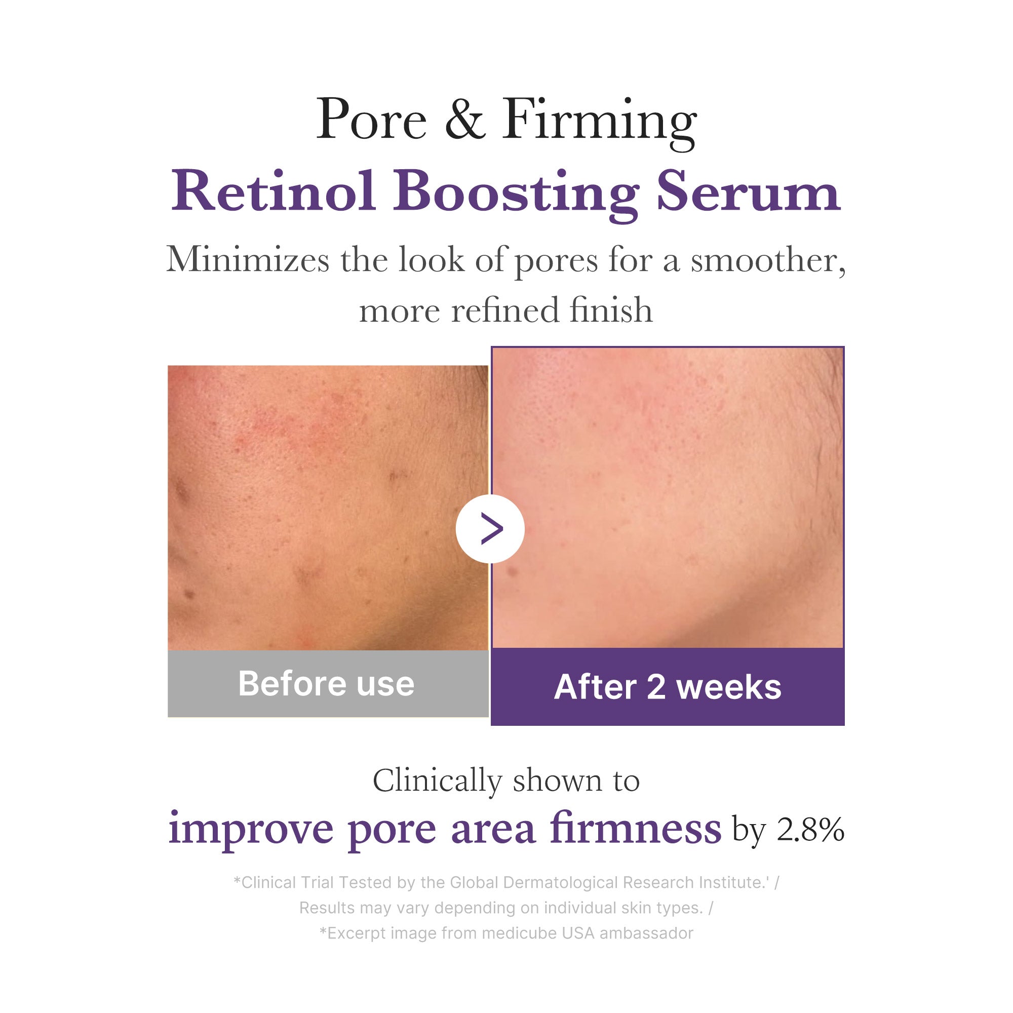 Retinol NMN Boosting Serum - Put your preferences first.