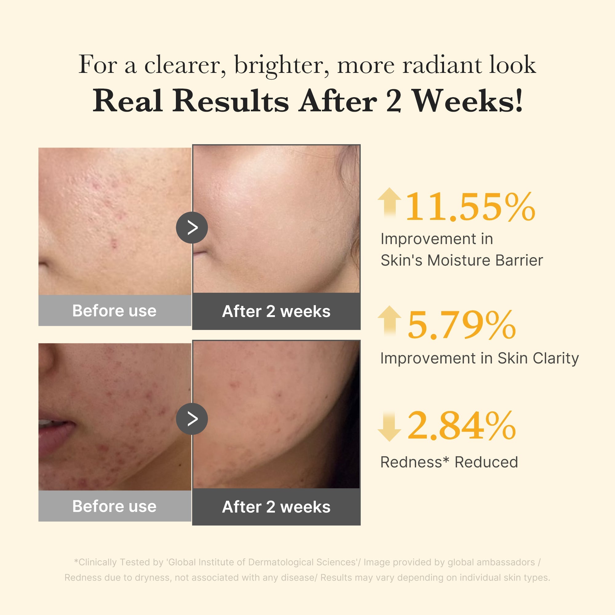 Kojic Acid Turmeric Capsule Serum - Ease into your morning.