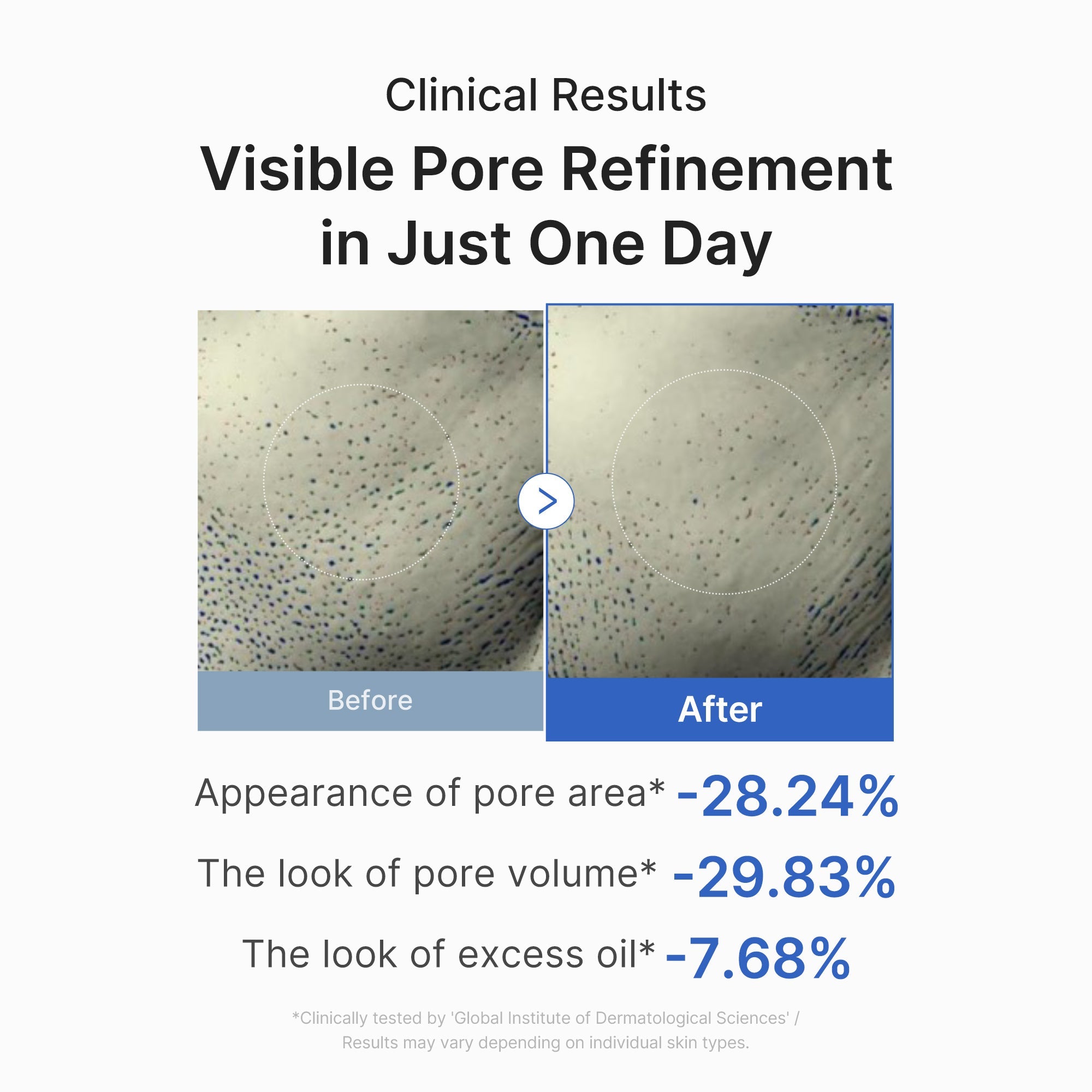 Zero Pore One-day Peptide Serum - Let your skincare reflect you.