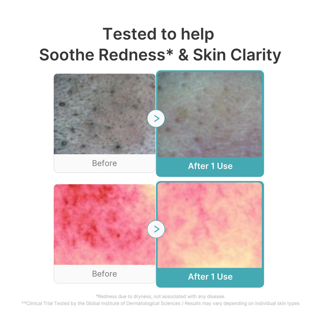 Azelaic Acid Capsule Foam Cleanser - This evening is yours.