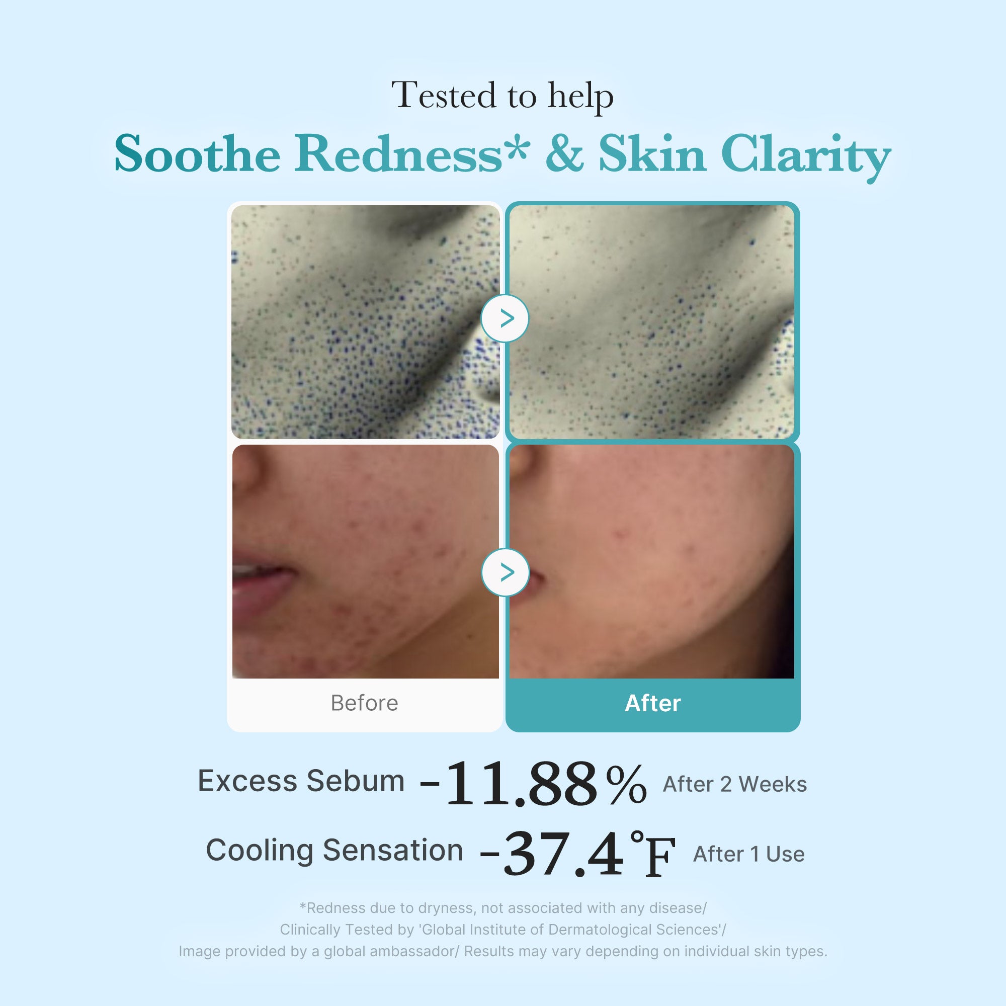 Azelaic Acid Niacinamide Clarifying Toner - From shower to self-care.