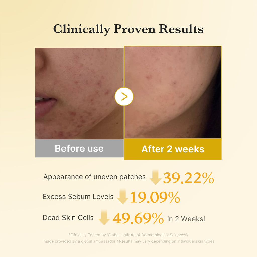 Kojic Acid Turmeric Toner Pad - The thoughtful side of beauty.
