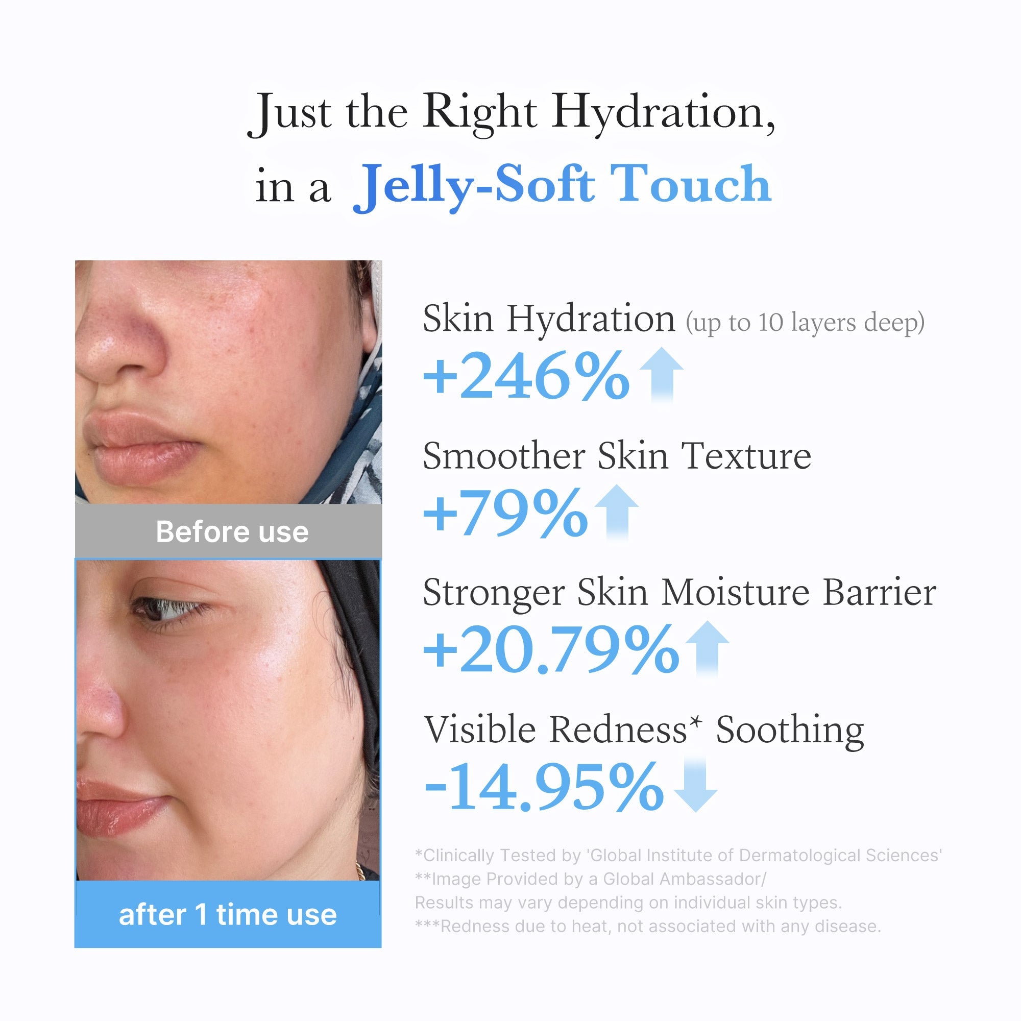 Hyaluronic Ceramide Moisturizing Jelly Cream - See where good care goes.