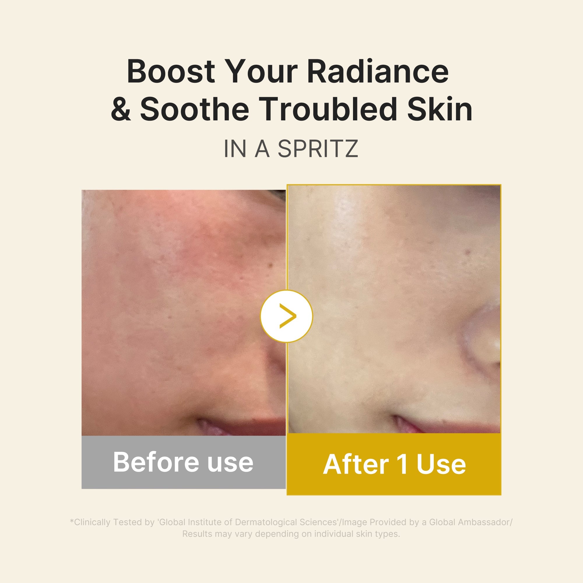 Kojic Acid Turmeric Vitamin Gold Jelly Mist Serum - Beauty time is your time.