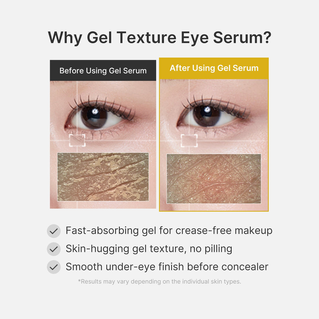 Kojic Acid Turmeric Eye Gel Serum - Bring care into the picture.