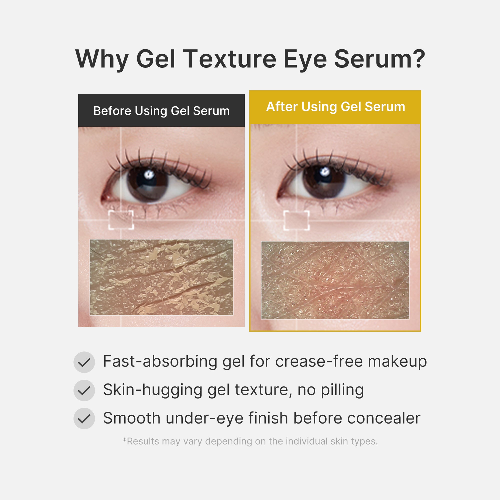 Kojic Acid Turmeric Eye Gel Serum - Bring care into the picture.