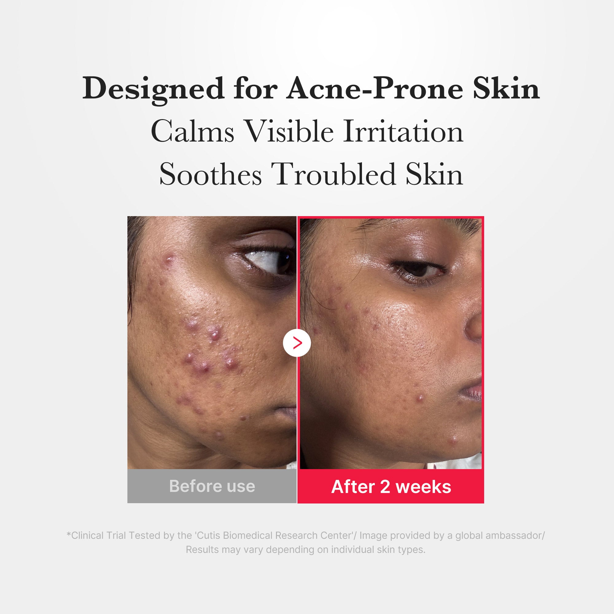 Hypochlorous Acid Power Soothing Spray - Speak fluent skincare.