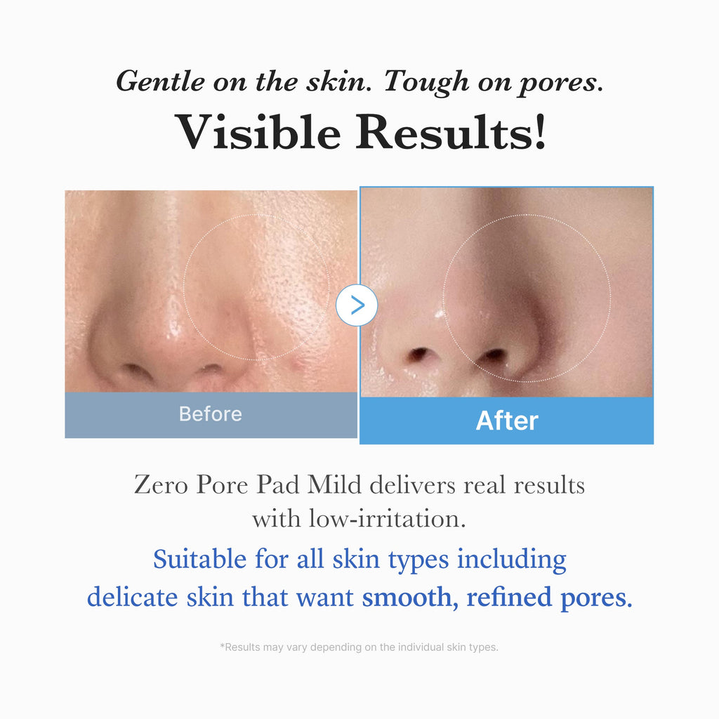 Zero Pore Madecassoside Pads (Mild) - Your next Medicube chapter.