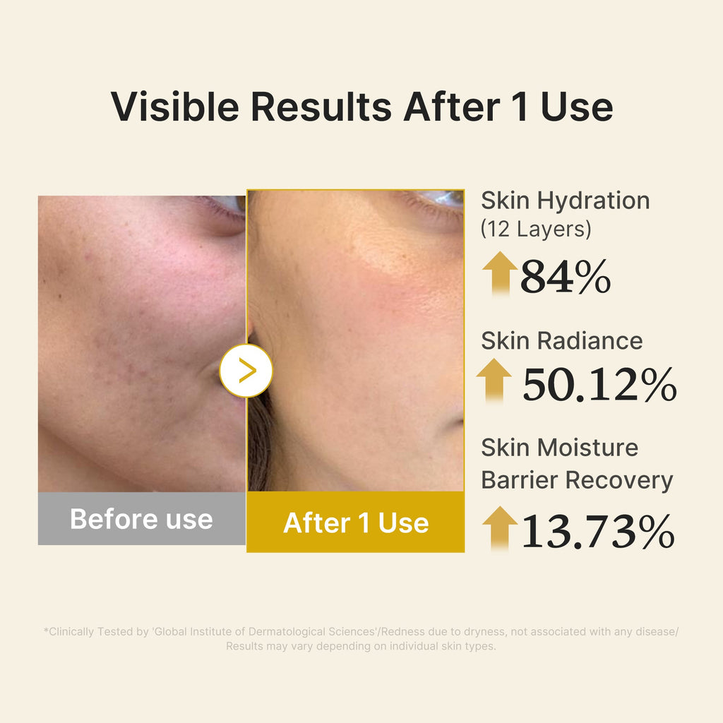 Kojic Acid Turmeric Vitamin Gold Jelly Mist Serum - Beauty time is your time.