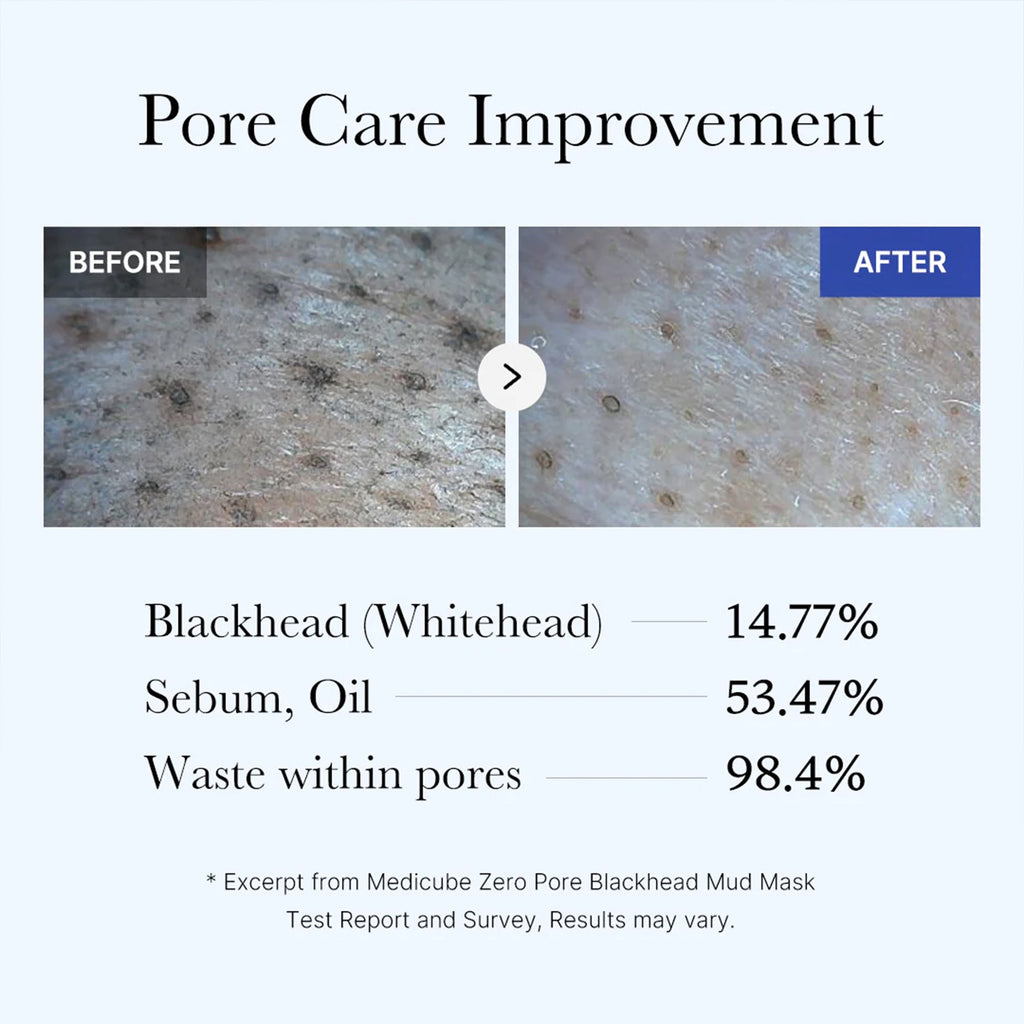 Zero Pore Blackhead Mud Mask - Skincare worth a closer look.