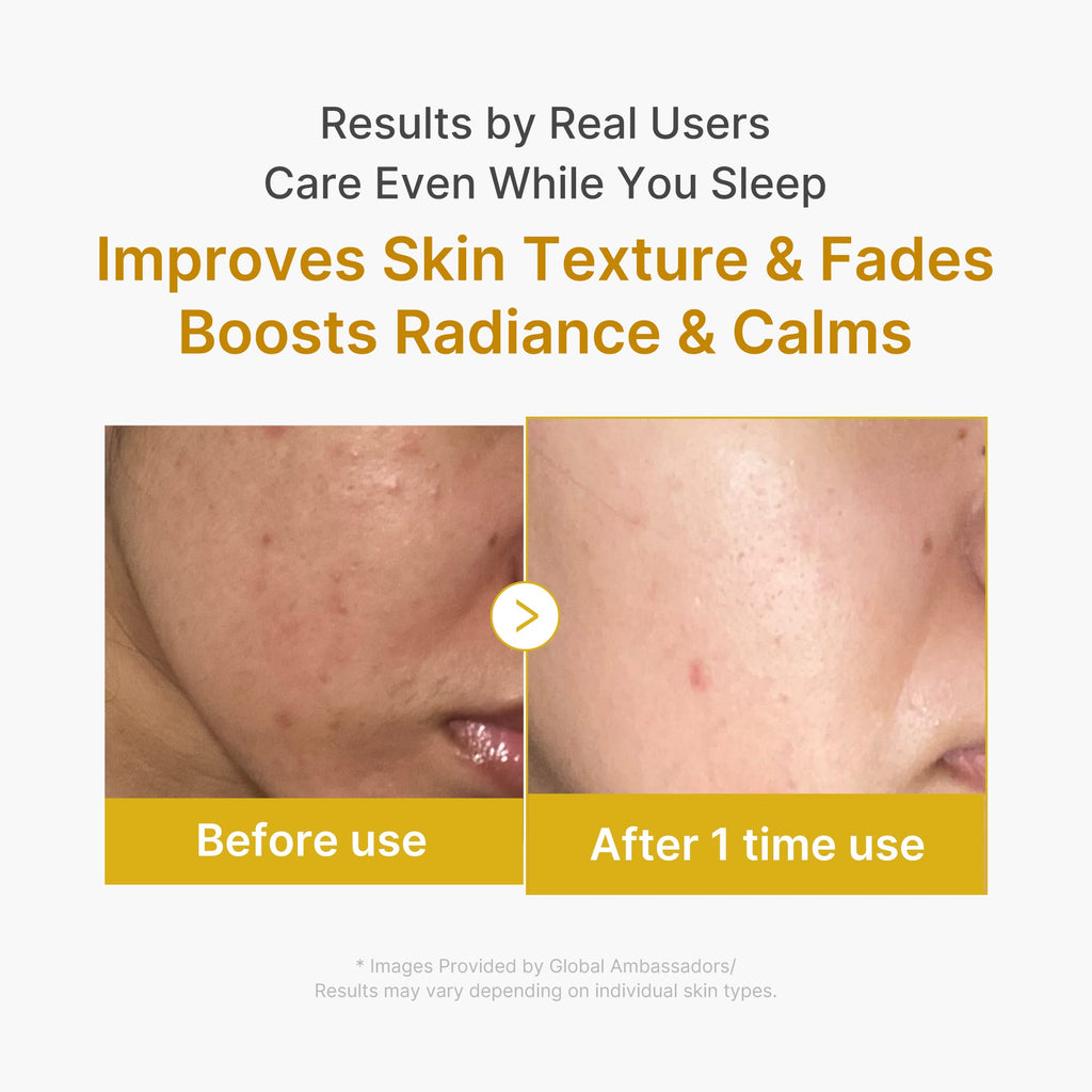 Kojic Acid Turmeric Overnight Wrapping Mask - A little more Medicube.