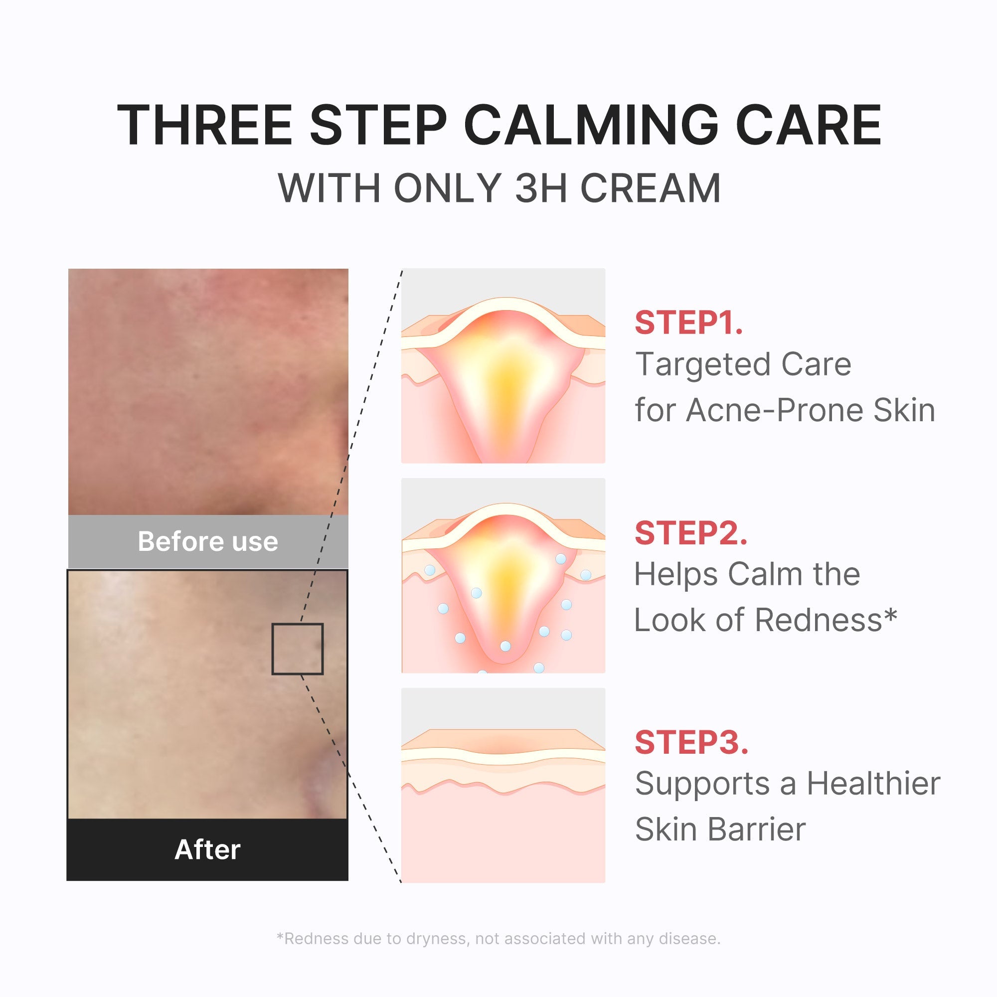 3H Daily Relief Cream - Good care. Great company.