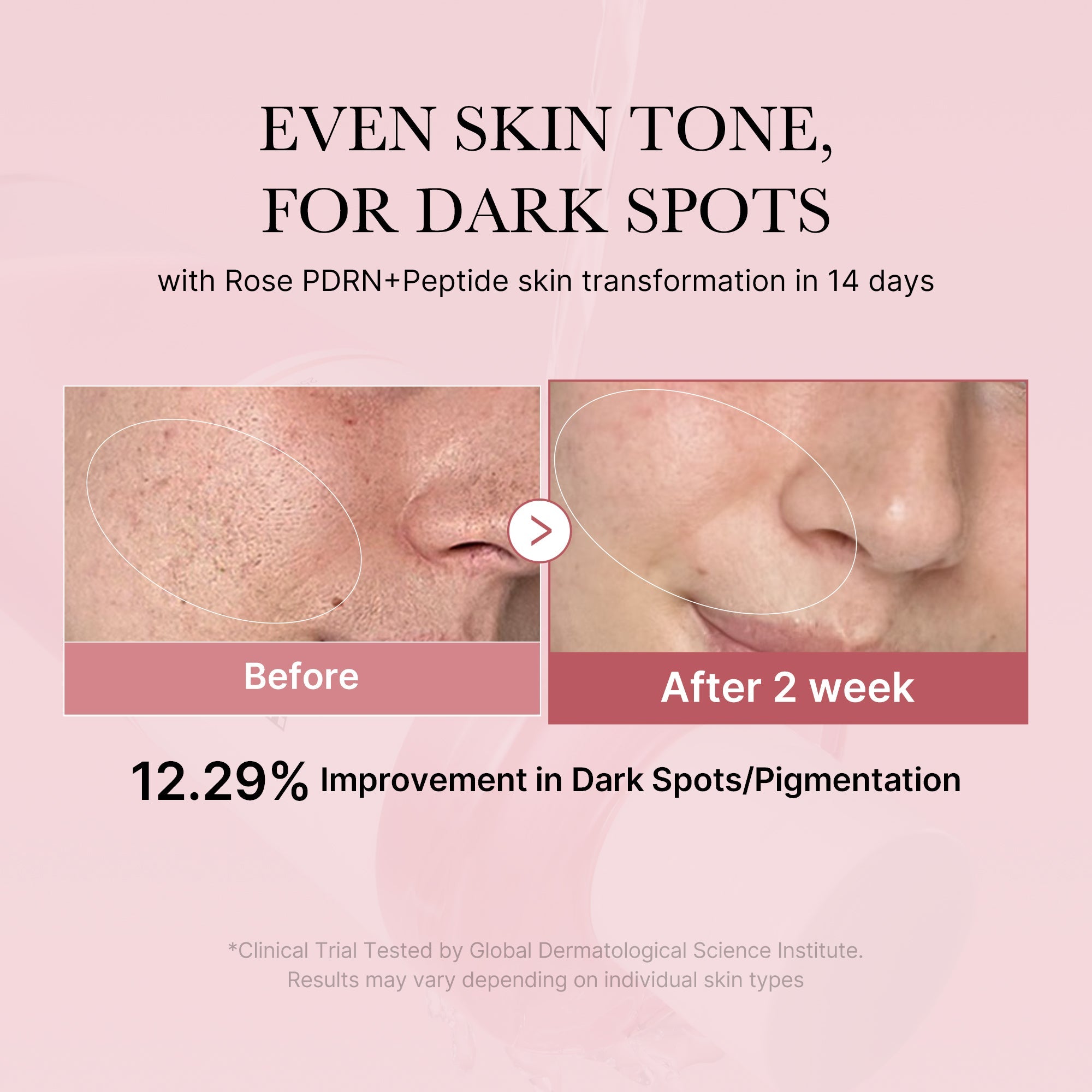 PDRN Pink Peptide Toner - K-beauty made personal.