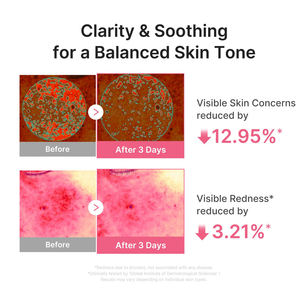Ultra Light PDRN Pink Peptide Serum - Your next beauty favorite.