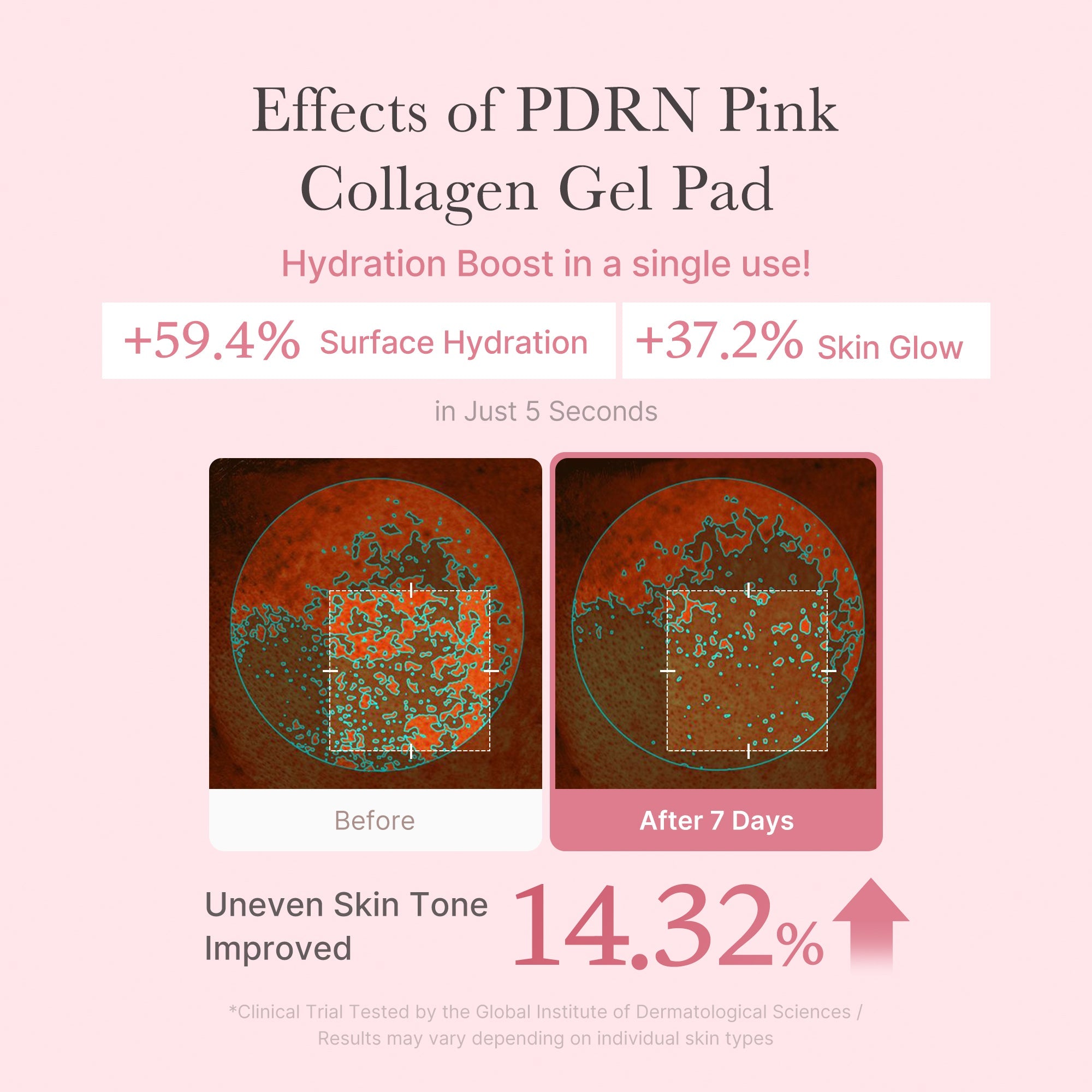 PDRN Pink Collagen Gel Toner Pad - A new look at K-beauty.