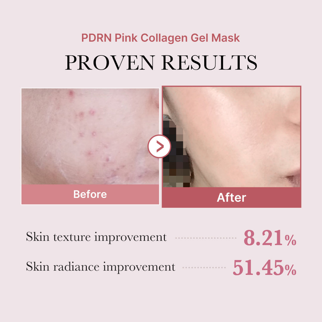 PDRN Pink Glow Full Set - A softer start awaits.