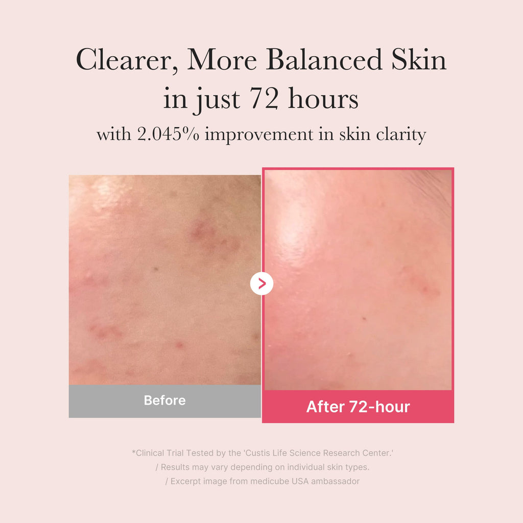 TXA Niacinamide Serum - Start the day your way.