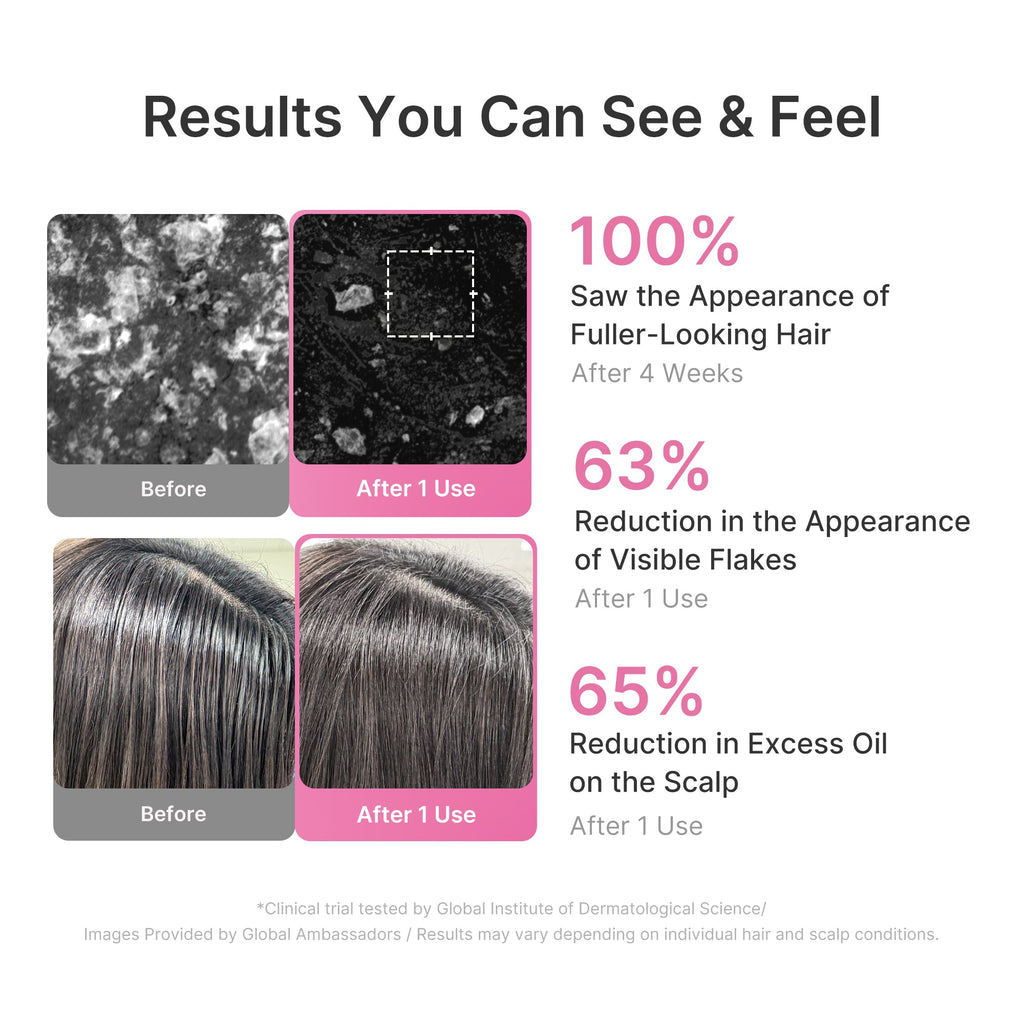 Rosemary PDRN Cooling Thickening Shampoo - A fresh start with Medicube.