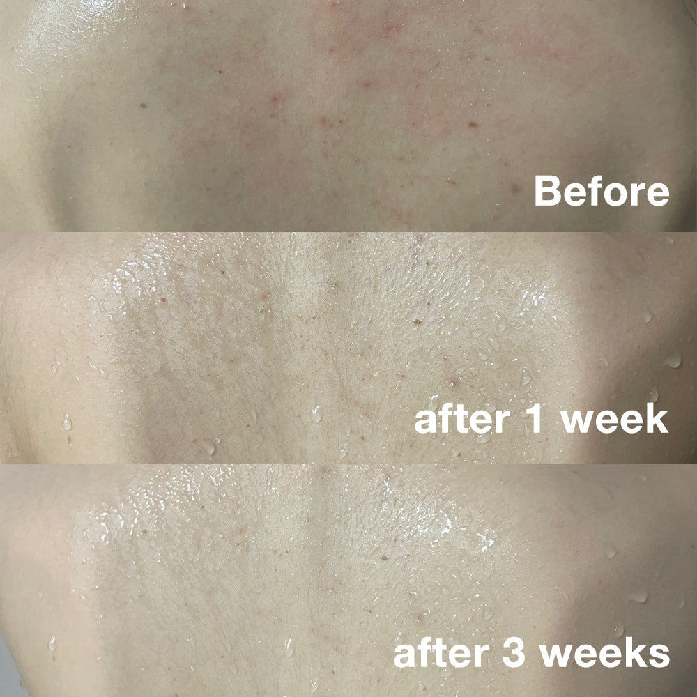 Red Line Ultimate Face & Body Care Set - Bring your care goals along.